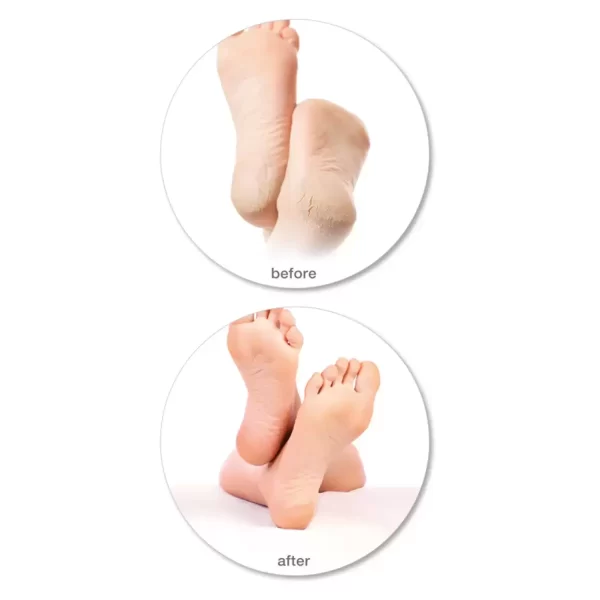 Rio 60 Second Pedi, Hard Skin Remover & Foot File - Image 3
